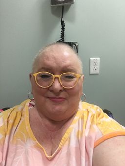 The color on these are a light cantaloupe more than yellow. The arms a1